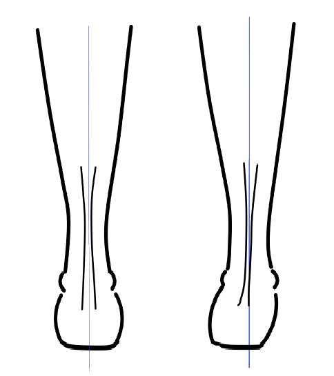 右足首の足の裏が内側を向いている。内反している絵