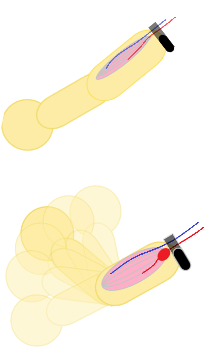 従来の加圧トレーニングは駆血しても血流が漏れやすい