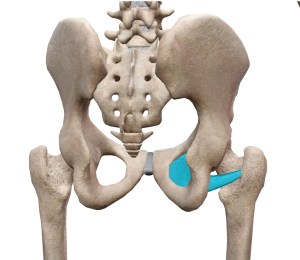 外閉鎖筋停止部