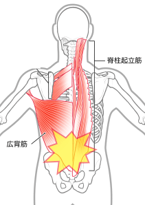 筋筋膜性の腰痛